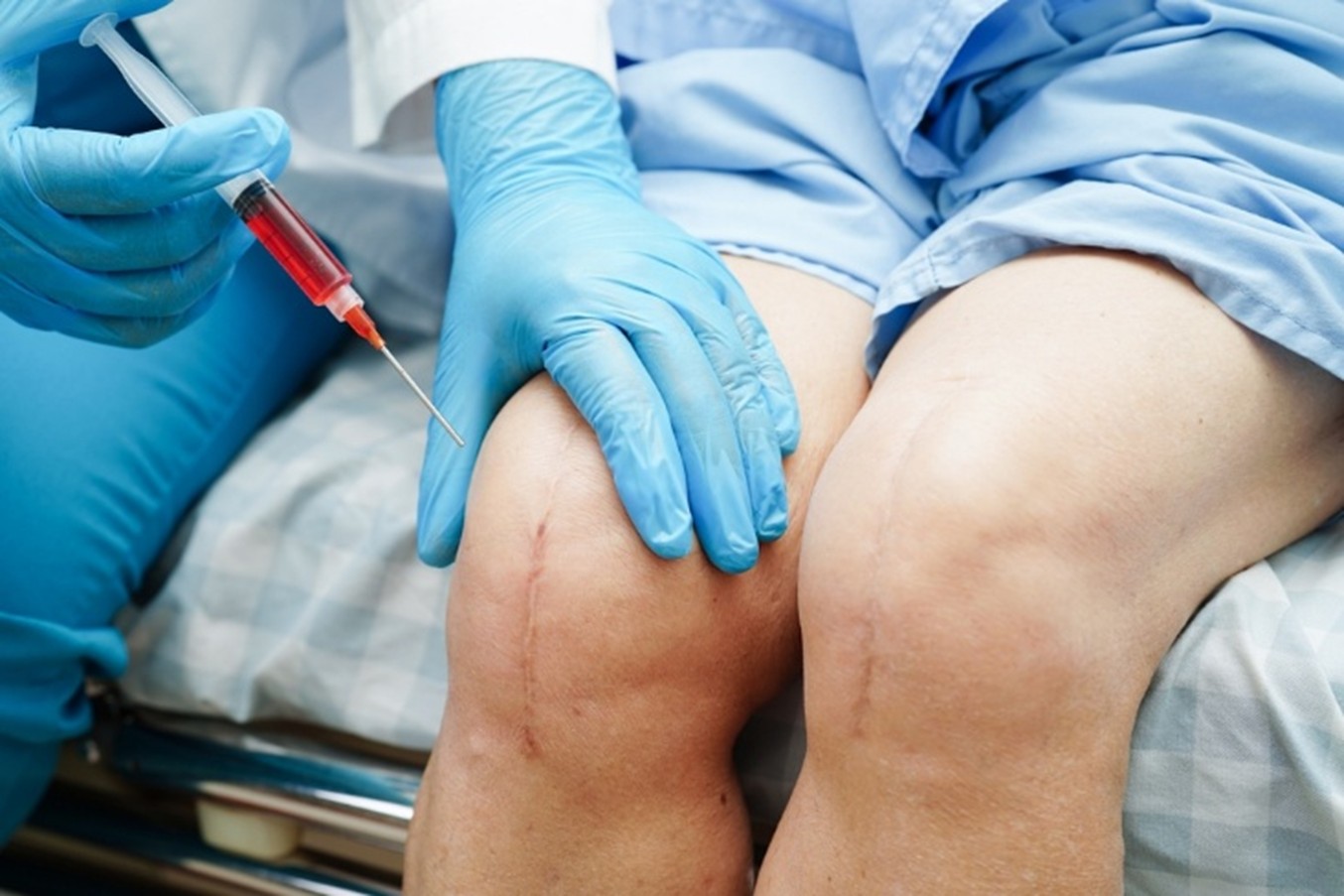 Rethinking Joint Degeneration Through PRP for Knee Osteoarthritis Nashville